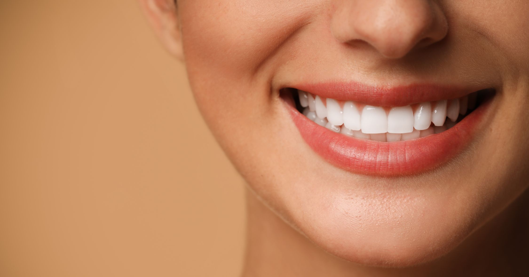 cover faccette dentali