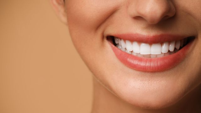 cover faccette dentali