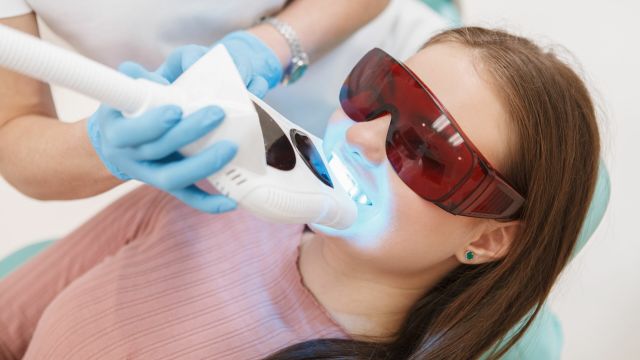 cover sbiancamento dentale